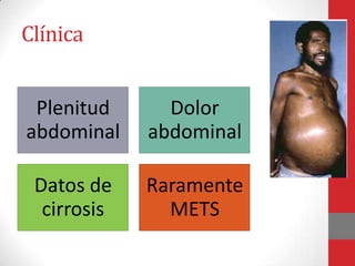Clínica


 Plenitud      Dolor
abdominal    abdominal

 Datos de    Raramente
  cirrosis     METS
 