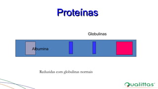 Albumina
Globulinas
ProteínasProteínas
Reduzidas com globulinas normais
 