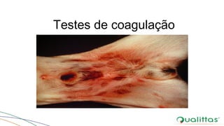 Testes de coagulação
 
