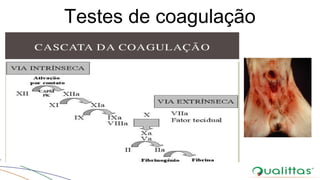 Testes de coagulação
 