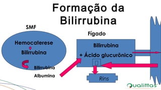 Formação da
Bilirrubina
Hemocaterese
Bilirrubina
SMF
Bilirrubina
+ Ácido glucurônico
Fígado
Bilirrubina
Albumina
Rins
 