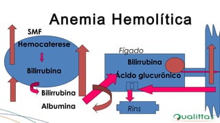 Anemia Hemolítica
Hemocaterese
Bilirrubina
SMF
Bilirrubina
+ Ácido glucurônico
Fígado
Bilirrubina
Albumina Rins
 