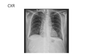 CXR
 