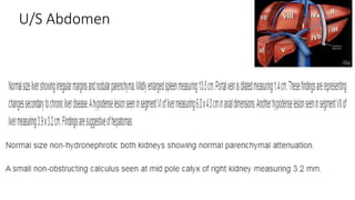 U/S Abdomen
 
