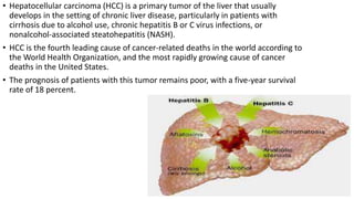 • Hepatocellular carcinoma (HCC) is a primary tumor of the liver that usually
develops in the setting of chronic liver disease, particularly in patients with
cirrhosis due to alcohol use, chronic hepatitis B or C virus infections, or
nonalcohol-associated steatohepatitis (NASH).
• HCC is the fourth leading cause of cancer-related deaths in the world according to
the World Health Organization, and the most rapidly growing cause of cancer
deaths in the United States.
• The prognosis of patients with this tumor remains poor, with a five-year survival
rate of 18 percent.
 