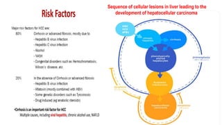 Sequence of cellular lesions in liver leading to the
development of hepatocellular carcinoma
 