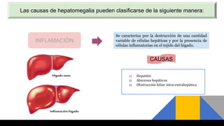 Se caracteriza por la destrucción de una cantidad
variable de células hepáticas y por la presencia de
células inflamatorias en el tejido del hígado.
Las causas de hepatomegalia pueden clasificarse de la siguiente manera:
INFLAMACIÓN
CAUSAS
1) Hepatitis
2) Abscesos hepáticos
3) Obstrucción biliar intra-extrahepática
 