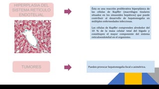 HIPERPLASIA DEL
SISTEMA RETÍCULO
ENDOTELIAL
Ésta es una reacción proliferativa hiperplásica de
las células de Kupffer (macrófagos tisulares
situados en los sinusoides hepáticos) que puede
contribuir al desarrollo de hepatomegalia en
múltiples enfermedades infecciosas.
Las células de Kupffer comprenden alrededor del
10 % de la masa celular total del hígado y
constituyen el mayor componente del sistema
reticuloendotelial en el organismo.
TUMORES Pueden provocar hepatomegalia focal o asimétrica.
 