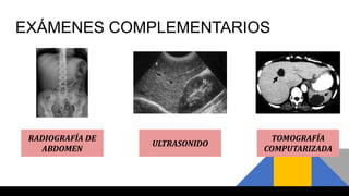 EXÁMENES COMPLEMENTARIOS
TOMOGRAFÍA
COMPUTARIZADA
RADIOGRAFÍA DE
ABDOMEN
ULTRASONIDO
 