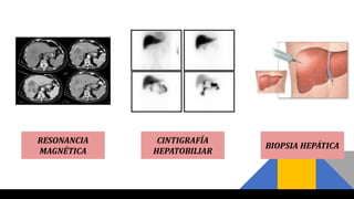 BIOPSIA HEPÁTICA
RESONANCIA
MAGNÉTICA
CINTIGRAFÍA
HEPATOBILIAR
 