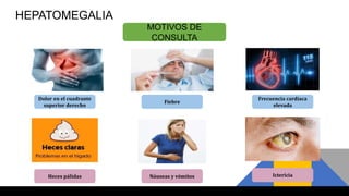 MOTIVOS DE
CONSULTA
Dolor en el cuadrante
superior derecho
HEPATOMEGALIA
Ictericia
Frecuencia cardiaca
elevada
Fiebre
Náuseas y vómitosHeces pálidas
 