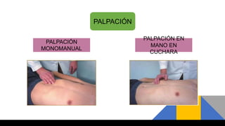 PALPACIÓN
PALPACIÓN
MONOMANUAL
PALPACIÓN EN
MANO EN
CUCHARA
 