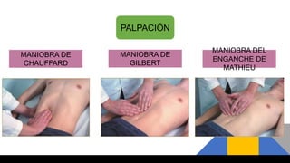 PALPACIÓN
MANIOBRA DE
CHAUFFARD
MANIOBRA DE
GILBERT
MANIOBRA DEL
ENGANCHE DE
MATHIEU
 