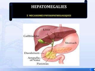 HEPATOMEGALIES
5 MECANISMES PHYSIOPATHOLOGIQUES
 