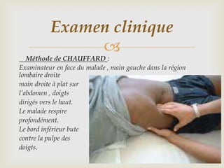 Examen clinique
                
   Méthode de CHAUFFARD :
Examinateur en face du malade , main gauche dans la région
lombaire droite
main droite à plat sur
l’abdomen , doigts
dirigés vers le haut.
Le malade respire
profondément.
Le bord inférieur bute
contre la pulpe des
doigts.
 