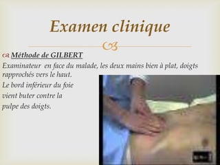 Examen clinique
 Méthode de GILBERT
                     
Examinateur en face du malade, les deux mains bien à plat, doigts
rapprochés vers le haut.
Le bord inférieur du foie
vient buter contre la
pulpe des doigts.
 