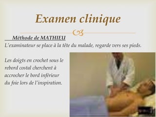 Examen clinique
   Méthode de MATHIEU
                      
L’examinateur se place à la tête du malade, regarde vers ses pieds.

Les doigts en crochet sous le
rebord costal cherchent à
accrocher le bord inférieur
du foie lors de l’inspiration.
 