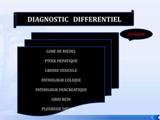 DIAGNOSTIC DIFFERENTIEL
                           CLINIQUE



     LOBE DE RIEDEL

     PTOSE HEPATIQUE

     GROSSE VESICULE

   PATHOLOGIE COLIQUE

 PATHOLOGIE PANCREATIQUE

        GROS REIN

   PLEURESIE DROITE …
 