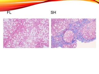 FL SH
 