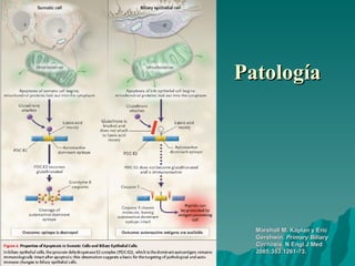 Patología Marshall M. Kaplan y Eric Gershwin.  Primary Biliary Cirrhosis.  N Engl J Med 2005;353:1261-73. 