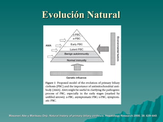 Evolución Natural Masanori Abe y Morikazu Onji.  Natural history of primary biliary cirrhosis.   Hepatology Research 2008; 38: 639–645   