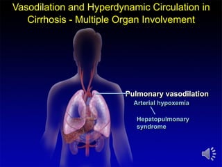 Hepatopatias cronicas. Cirrosis y sus complicaciones.ppsx