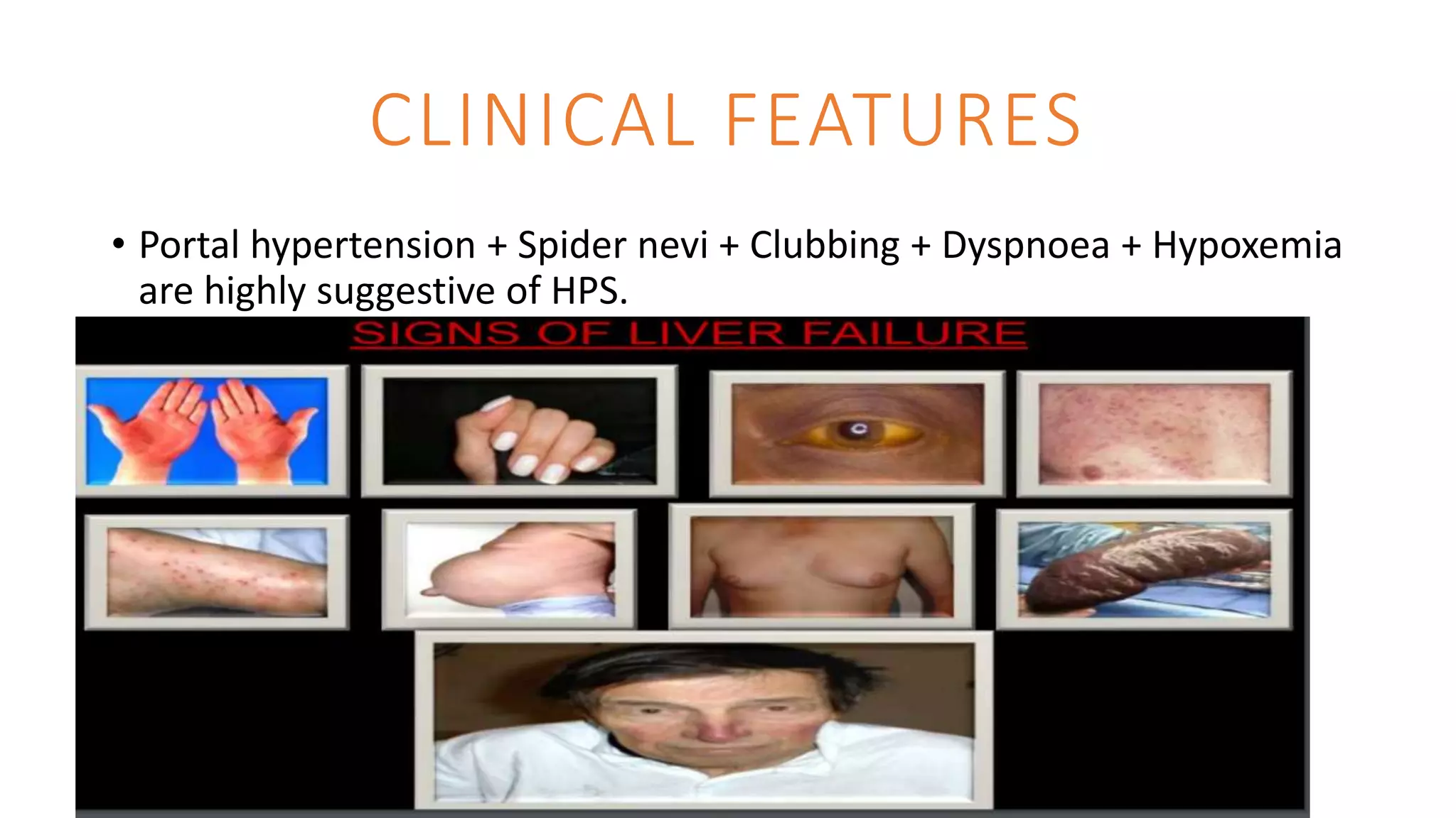 Hps Rash Hepato pulmonary syndrome | PPTX