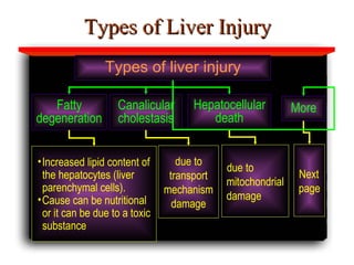 Types of Liver Injury Fatty degeneration Canalicular cholestasis Hepatocellular death More Increased lipid content of the hepatocytes (liver parenchymal cells).  Cause can be nutritional or it can be due to a toxic substance due to transport mechanism damage due to mitochondrial damage Next page Types of liver injury 