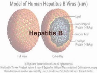 Hepatitis B
 