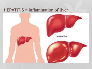 HEPATITIS = inflammation of liver
 