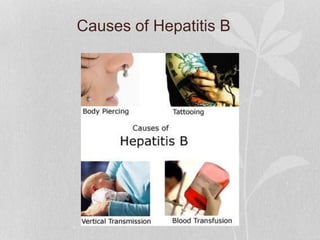 Causes of Hepatitis B
 