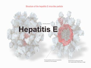 Hepatitis E
 