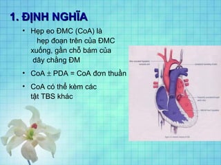 1. ĐỊNH NGHĨA
• Hẹp eo ĐMC (CoA) là
hẹp đoạn trên của ĐMC
xuống, gần chỗ bám của
dây chằng ĐM
• CoA ± PDA = CoA đơn thuần
• CoA có thể kèm các
tật TBS khác

 