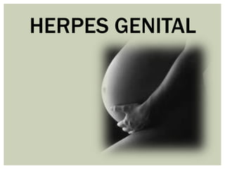 HERPES GENITAL
 