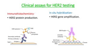 her2 ppt Copy in breast carcinomas and their role in therapy | PPTX