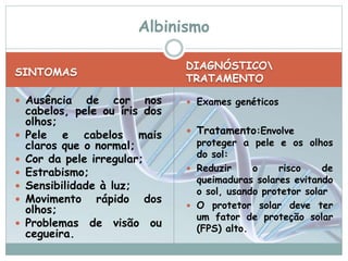SINTOMAS 
Albinismo 
DIAGNÓSTICO 
TRATAMENTO 
 Ausência de cor nos 
cabelos, pele ou íris dos 
olhos; 
 Pele e cabelos mais 
claros que o normal; 
 Cor da pele irregular; 
 Estrabismo; 
 Sensibilidade à luz; 
 Movimento rápido dos 
olhos; 
 Problemas de visão ou 
cegueira. 
 Exames genéticos 
 Tratamento:Envolve 
proteger a pele e os olhos 
do sol: 
 Reduzir o risco de 
queimaduras solares evitando 
o sol, usando protetor solar 
 O protetor solar deve ter 
um fator de proteção solar 
(FPS) alto. 
 
