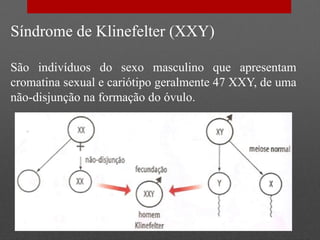 Síndrome de Klinefelter (XXY)
São indivíduos do sexo masculino que apresentam
cromatina sexual e cariótipo geralmente 47 XXY, de uma
não-disjunção na formação do óvulo.
 
