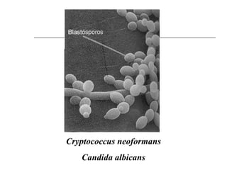 Cryptococcus neoformans
   Candida albicans
 