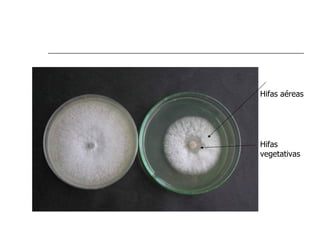 Hifas aéreas




Hifas
vegetativas
 