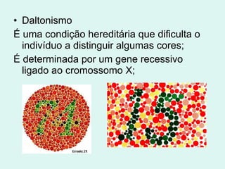 Daltonismo É uma condição hereditária que dificulta o indivíduo a distinguir algumas cores; É determinada por um gene recessivo ligado ao cromossomo X; 