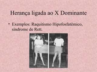 Herança ligada ao X Dominante Exemplos: Raquitismo Hipofosfatêmico, síndrome de Rett. 