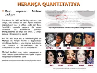 Caso especial: Michael
Jackson
Na década de 1980, ele foi diagnosticado com
vitiligo, uma doença de pele. Alguns médicos
especularam que o vitiligo pode ser tanto
hereditário quando decorrer de danos
causados por substâncias químicas
branqueadoras ao longo dos anos. O vitiligo
deixa a vítima sensível ao sol.
No fim dos anos 80, o dermatologista de
Michael, Dr. Arnold Kleinm, o diagnosticou
com lúpus discóide – uma doença auto-imune
que provoca o escurecimento ou o
clareamento da pele – no couro cabeludo.
Michael também usa muita maquiagem e
base pastosa para uniformizar a pele, o que a
faz parecer ainda mais clara.
FONTE: http://www.diariodeumadismorfia.com.br/blog/tag/michael-jackson/
http://rhythmofthetide.com/michael-jackson-vitiligo-timeline/
http://www.diariodeumadismorfia.com.br/blog/tag/michael-jackson/
HERANÇA QUANTITATIVAHERANÇA QUANTITATIVA
 