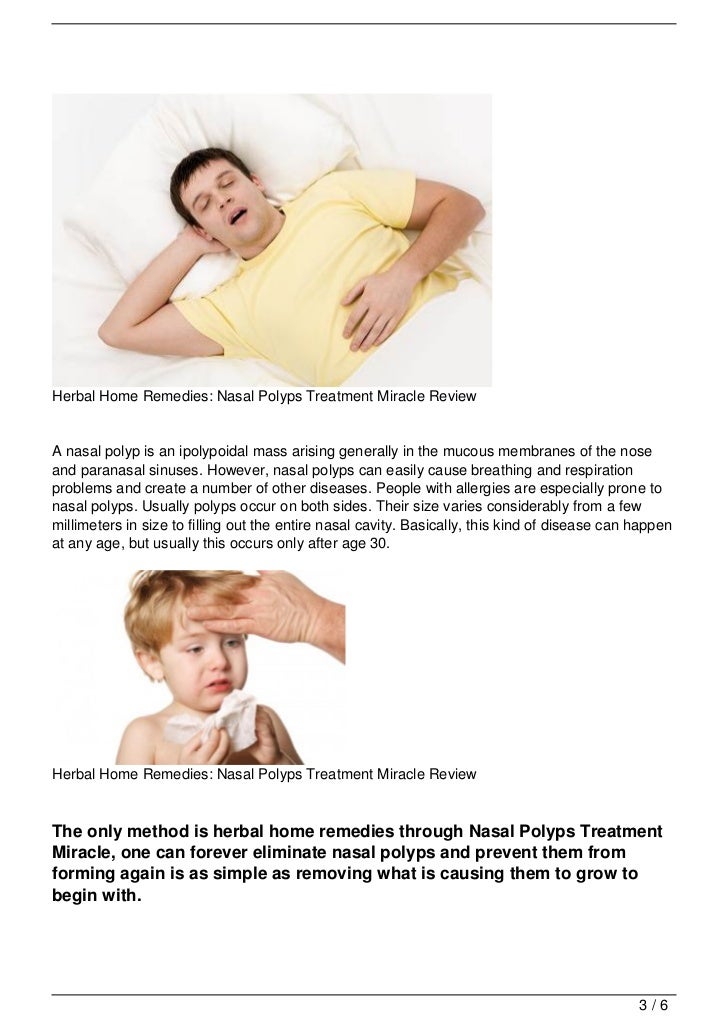 Herbal Home Remedies Nasal Polyps Treatment Miracle Review