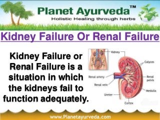 Kidney Failure Or Renal Failure
Kidney Failure or
Renal Failure is a
situation in which
the kidneys fail to
function adequately.
 