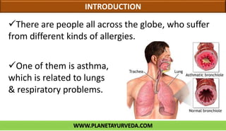 WWW.PLANETAYURVEDA.COM
INTRODUCTION
One of them is asthma,
which is related to lungs
& respiratory problems.
There are people all across the globe, who suffer
from different kinds of allergies.
 