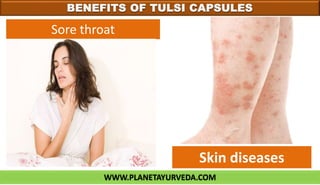 WWW.PLANETAYURVEDA.COM
BENEFITS OF TULSI CAPSULES
Sore throat
Skin diseases
 