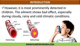WWW.PLANETAYURVEDA.COM
INTRODUCTION
However, it is most prominently detected in
children. The ailment shows bad effect, especially
during cloudy, rainy and cold climatic conditions.
 