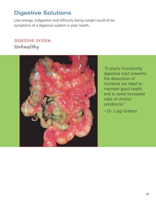 Digestive Solutions
Low energy, indigestion and difficulty losing weight could all be
symptoms of a digestive system in poor health.



DIGESTIVE SYSTEM
Unhealthy



                                                          “A poorly functioning
                                                          digestive tract prevents
                                                          the absorption of
                                                          nutrients we need to
                                                          maintain good health
                                                          and to avoid increased
                                                          risks of chronic
                                                          conditions.”
                                                          – Dr. Luigi Gratton




                                                                                 23
 
