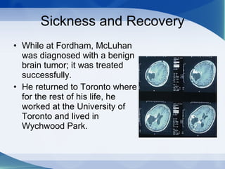 Sickness and Recovery While at Fordham, McLuhan was diagnosed with a benign brain tumor; it was treated successfully.  He returned to Toronto where for the rest of his life, he worked at the University of Toronto and lived in Wychwood Park. 