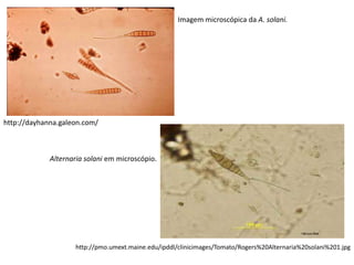 http://pmo.umext.maine.edu/ipddl/clinicimages/Tomato/Rogers%20Alternaria%20solani%201.jpg
http://dayhanna.galeon.com/
Imagem microscópica da A. solani.
Alternaria solani em microscópio.
 